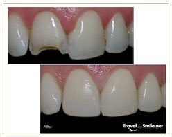 Slider image (6) Travel and Smile